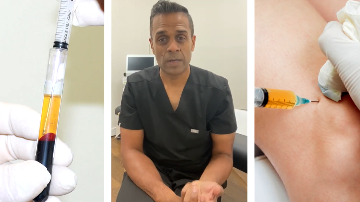 How to get rid of joint and tendon pain with Platelet Rich Plasma (PRP)