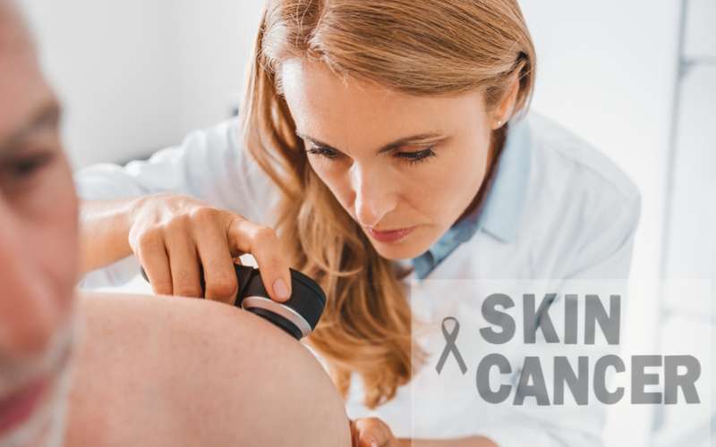 Dr. Anna Chacon’s Expert Advice and Facts on Skin Cancer Diagnosis and Treatment